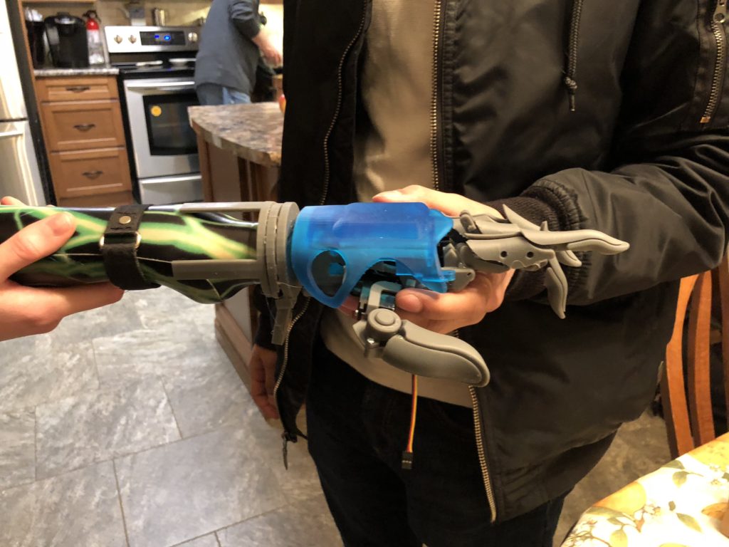 smartARM prosthetic hand